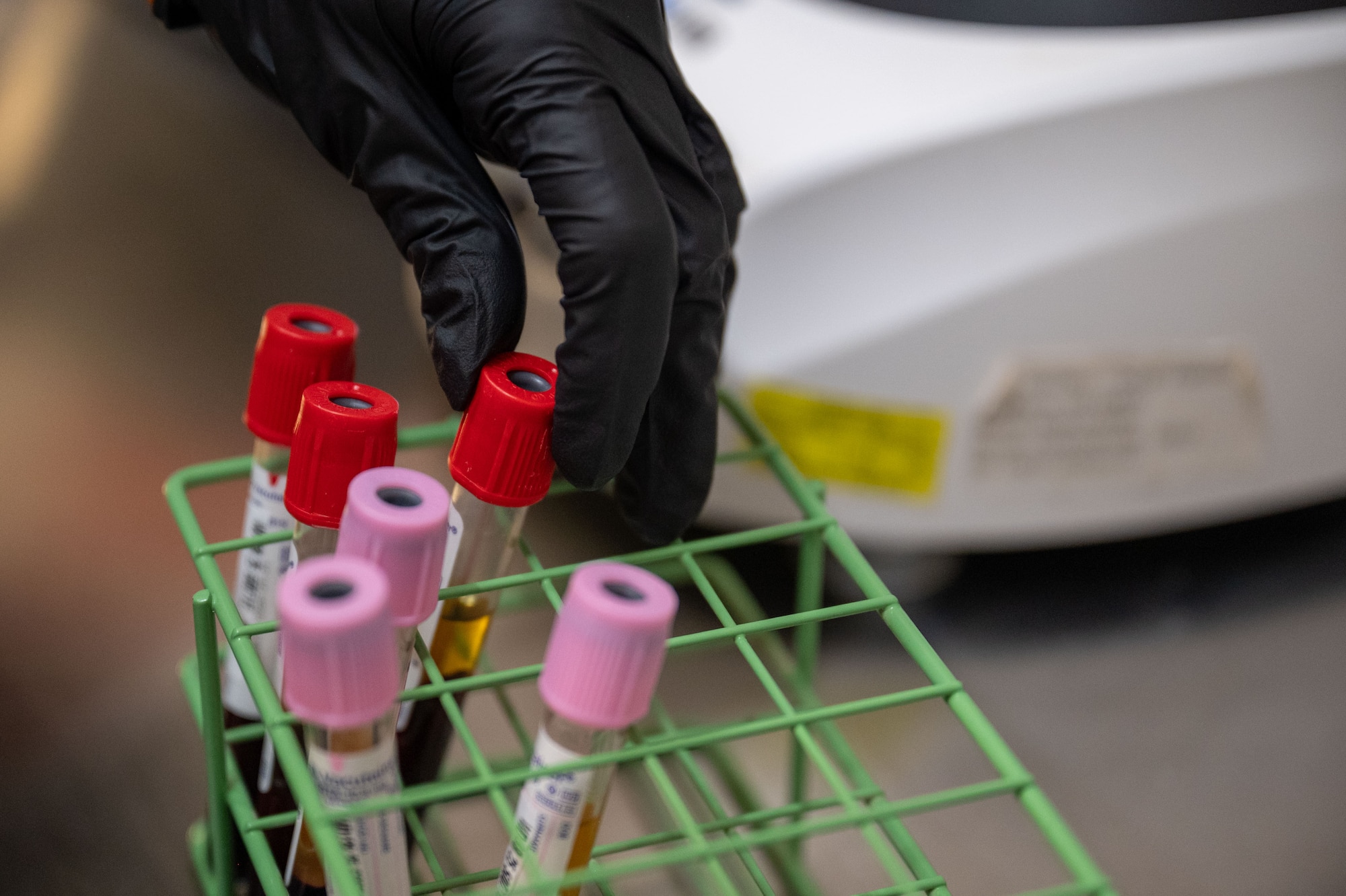 A blood sample is placed in a test tube holder.