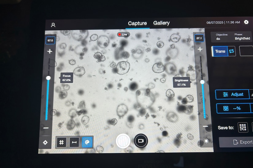 A screen shows various black splotches and circles.