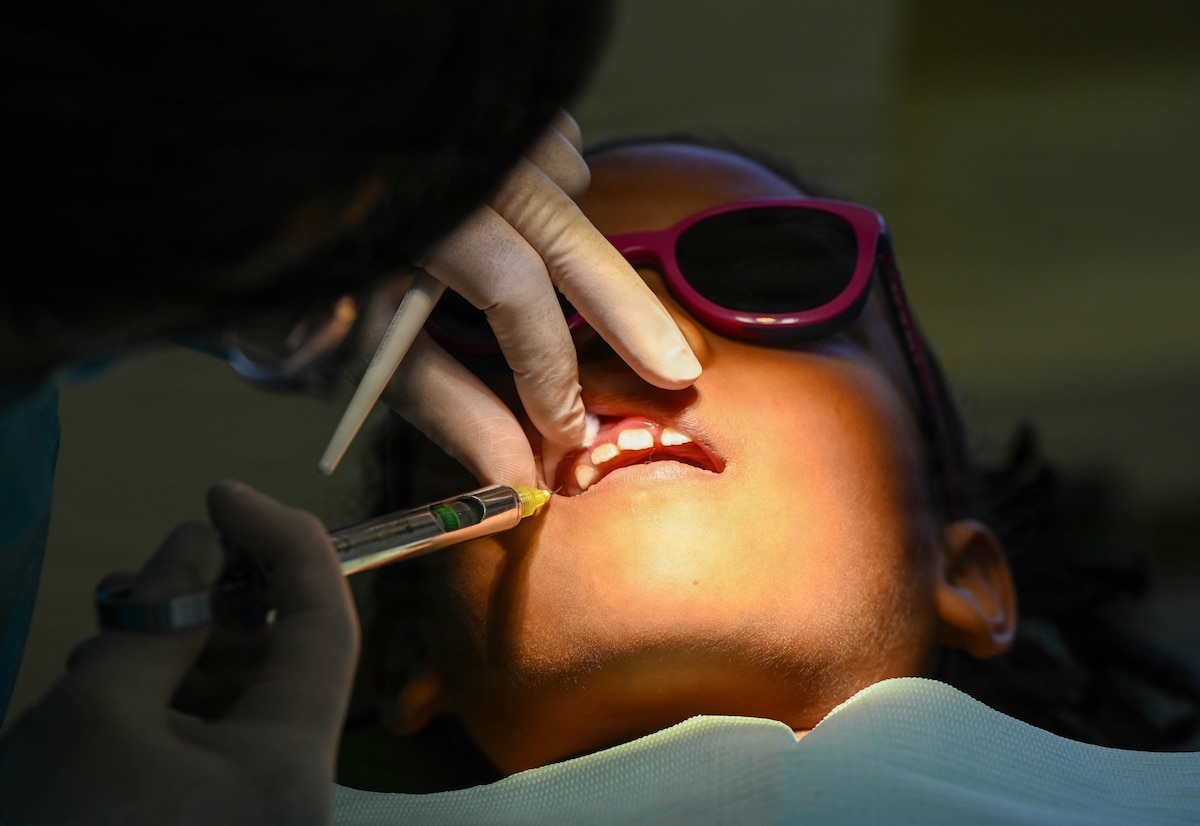 A U.S. Air Force Reserve dentist prepares a pediatric patient for a tooth extraction at Cheddi Jagan Dental School in Georgetown, Guyana, March 18, 2026. During the Lesser Antilles Medical Assistance Team (LAMAT) 2026 mission, preventive dental care and early treatment played a key role in maintaining oral health and reducing the progression of dental disease in children. (U.S. Air Force photo by Staff Sgt. Dakota Carter)
