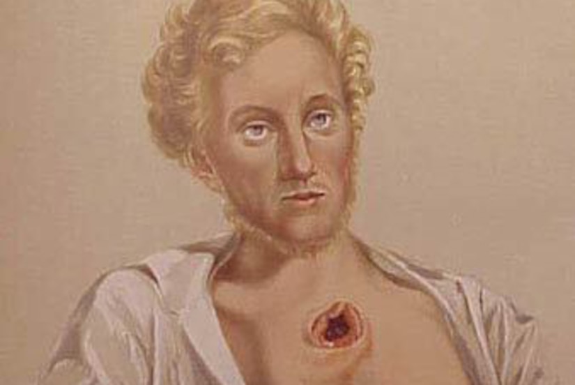 A painting shows a man with a gaping chest wound.