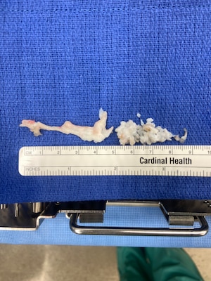 260408-N-TW242-1005 Okinawa, Japan (April 10, 2026) Lt. Cmdr. Ki Chang a Navy Medical Corps Officer and Staff Neurosurgeon at Naval Medical Center San Diego performed the first uniportal endoscopic spine surgery at U.S. Naval Hospital Okinawa, performs the procedure. (U.S. Navy photo by Courtesy Credit)