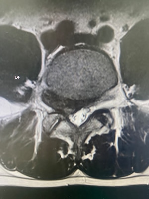 260408-N-TW242-1006 Okinawa, Japan (April 10, 2026) Lt. Cmdr. Ki Chang a Navy Medical Corps Officer and Staff Neurosurgeon at Naval Medical Center San Diego performed the first uniportal endoscopic spine surgery at U.S. Naval Hospital Okinawa, explains the procedure. (U.S. Navy photo by Courtesy Credit)