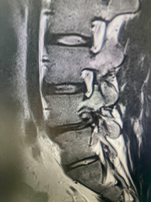 260408-N-TW242-1003 Okinawa, Japan (April 10, 2026) Lt. Cmdr. Ki Chang a Navy Medical Corps Officer and Staff Neurosurgeon at Naval Medical Center San Diego performed the first uniportal endoscopic spine surgery at U.S. Naval Hospital Okinawa, explains the procedure. (U.S. Navy photo by Courtesy Credit)