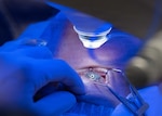 U.S. Air Force medical personnel perform a laser vision correction procedure at the Joint Warfighter Refractive Surgery Center at Joint Base San Antonio-Lackland, Texas, April 15, 2026. The procedure helps reduce service members’ reliance on glasses and contact lenses, improving readiness and mission effectiveness. (U.S. Air Force photo by Senior Airman Matthew-John Braman)