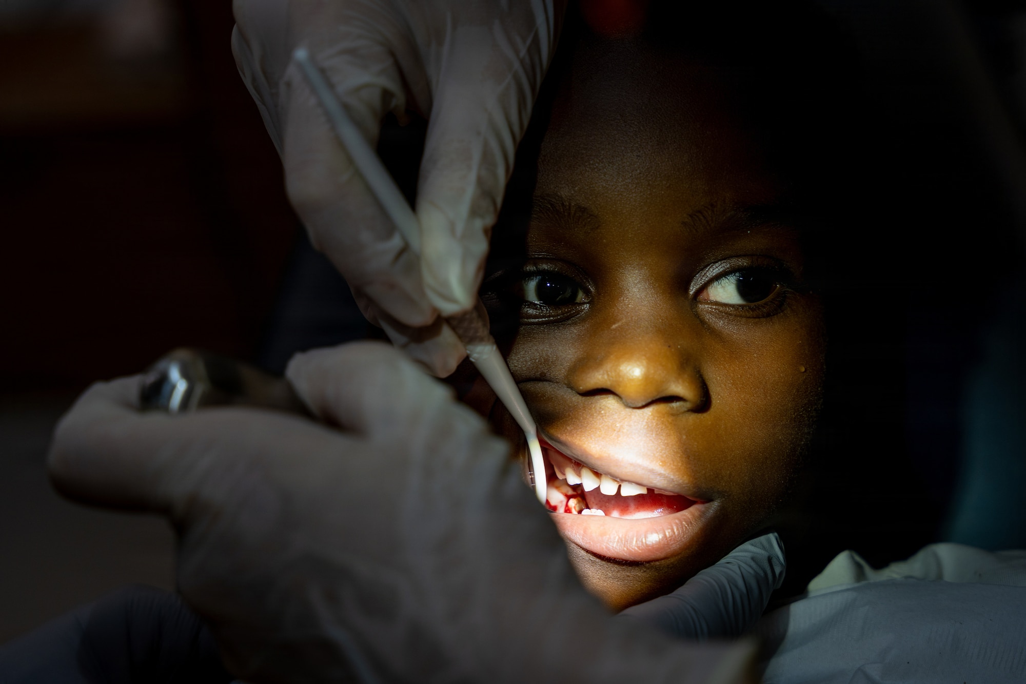 U.S. Air Force Maj. Kelsey Geiger, 434th Aerospace Medicine Squadron dentist, examines a child’s mouth during a Lesser Antilles Medical Assistance Team (LAMAT) 2026 mission in Brownsweg, Suriname, April 15, 2026. LAMAT 2026 enhances readiness and partnerships by enabling U.S. and Surinamese providers to deliver side-by-side care while strengthening coordination in emergency medicine. (U.S. Air Force photo by Staff Sgt. Joshua Hastings)