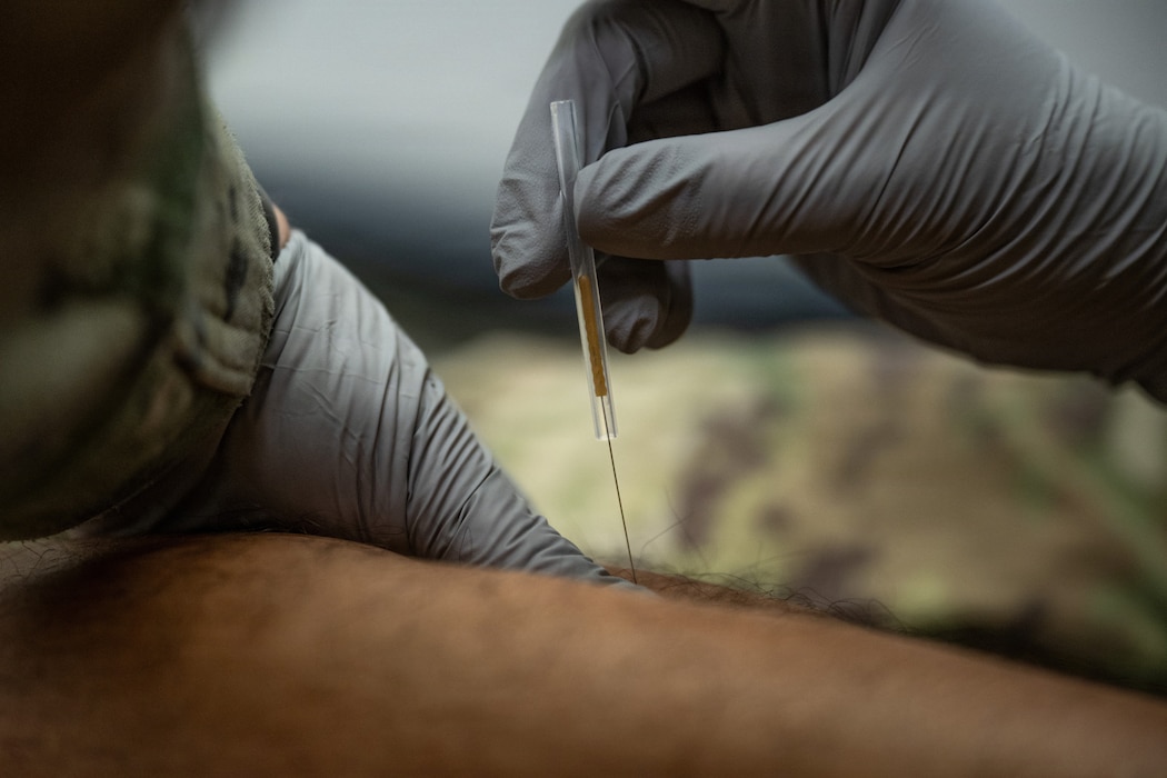 U.S. Air Force Maj. Jenna Boyd, 86th Medical Group physical therapy officer in charge, performs dry needling on Senior Airman Jason Perry, 86th Operational Medical Readiness Squadron physical therapy technician at Ramstein Air Base, Germany, August 3, 2026