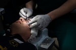 A surgeon holds forceps with his right hand above a patient's left eye during a photorefractive keratectomy (PRK) procedure at Walter Reed National Military Medical Center.