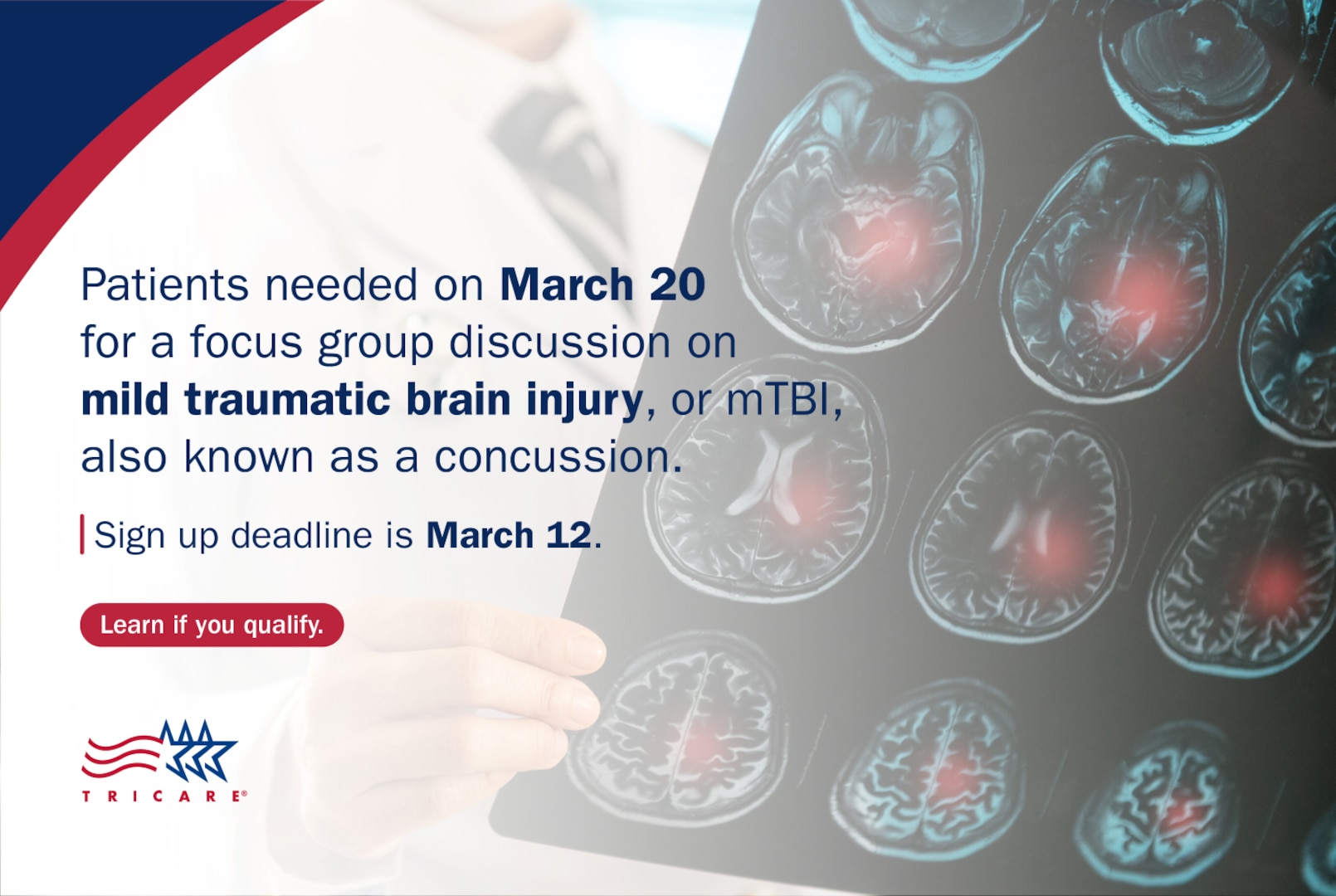 "Patients needed on March 20 for a focus group discussion on mild traumatic brain injury, or mTBI, also known as a concussion; Sign up deadline is March 12;" Doctor holds up brain scans.