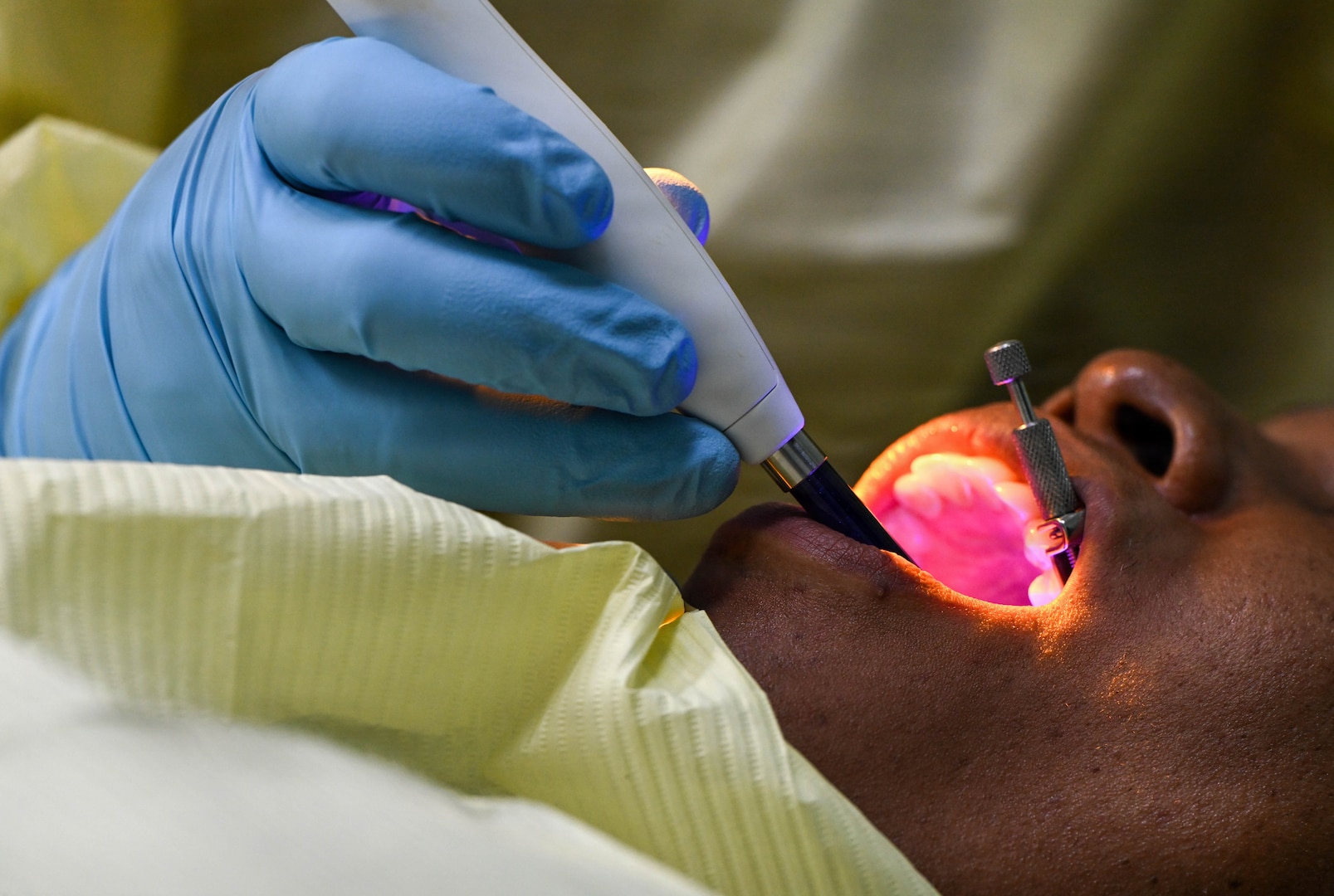 A U.S. Air Force Reserve general dentist attached to the 419th Medical Squadron repairs a dental filling on a Nevisian patient at Charlestown Dental Clinic in Charlestown, Nevis, Feb. 24, 2026. This procedure was part of the Lesser Antilles Medical Assistance Team 2026 mission, which strengthens host-nation healthcare systems while challenging U.S. Air Force and Reserve Airmen to adapt and deliver safe, effective care in a resource-constrained environments. (U.S. Air Force Photo by Staff Sgt. Dakota Carter)
