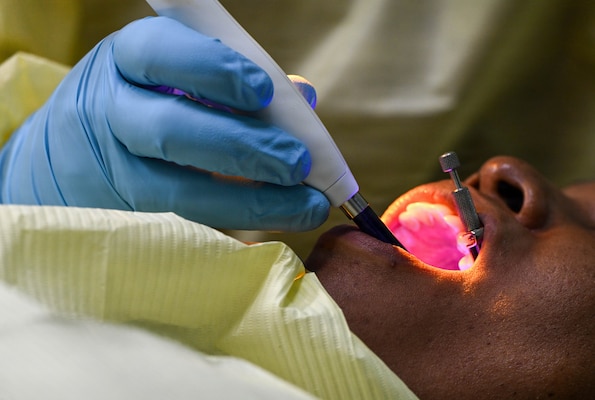A U.S. Air Force Reserve general dentist attached to the 419th Medical Squadron repairs a dental filling on a Nevisian patient at Charlestown Dental Clinic in Charlestown, Nevis, Feb. 24, 2026. This procedure was part of the Lesser Antilles Medical Assistance Team 2026 mission, which strengthens host-nation healthcare systems while challenging U.S. Air Force and Reserve Airmen to adapt and deliver safe, effective care in a resource-constrained environments. (U.S. Air Force Photo by Staff Sgt. Dakota Carter)