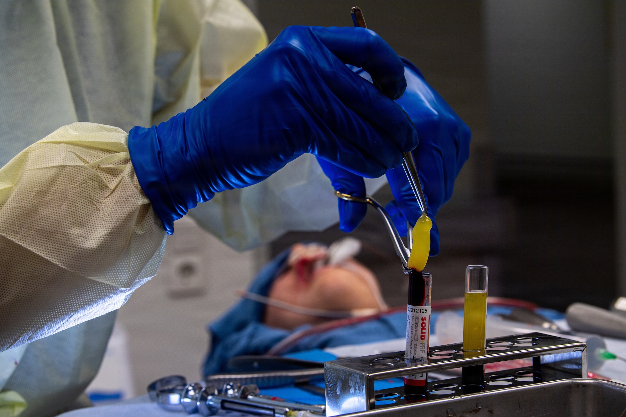 U.S. Air Force Maj. Matthew Van Hoof, 86th Dental Squadron oral and maxillofacial surgeon performs a platelet-rich-fibrin dental procedure at Ramstein Air Base, Germany, Jan. 13, 2026.