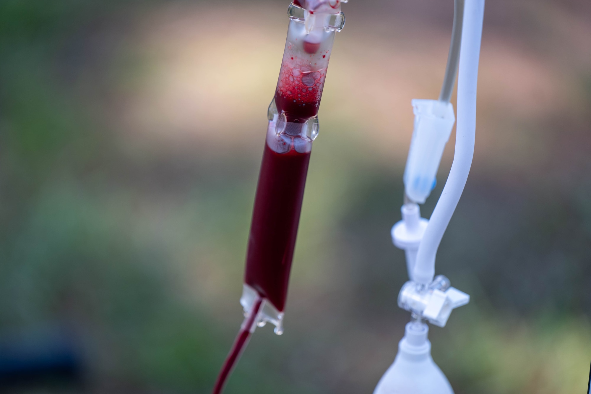 Blood flows through a transfusion line