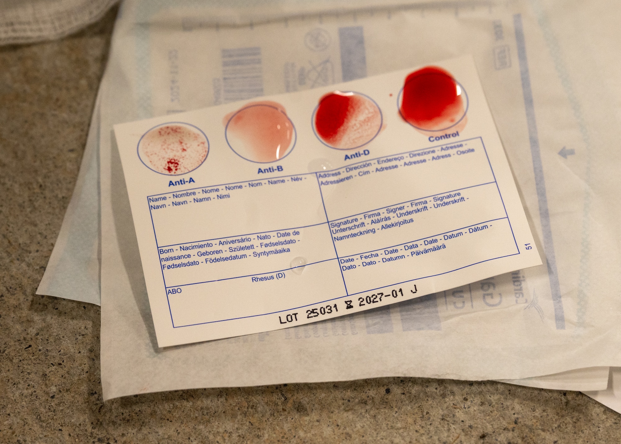 Blood is tested using an Eldon blood typing card.