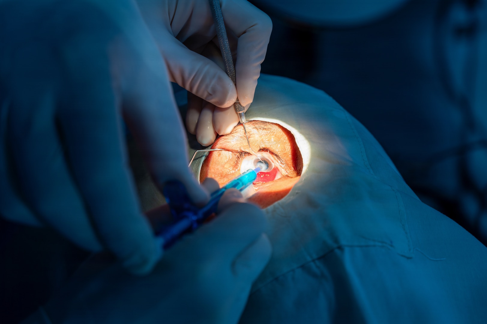 U.S. Air Force Lt. Col. Jessica Bolton, 96th Medical Group ophthalmologist, performs cataract surgery at the Georgetown Public Hospital Corporation in Georgetown, Guyana, March 17, 2026. During the Lesser Antilles Medical Assistance Team (LAMAT) 2026 mission, the Guyana Ministry of Health identified priority specialties based on national needs, enabling U.S. Air Force ophthalmology teams to sharpen clinical readiness while working alongside local providers to strengthen lasting partnerships. (U.S. Air Force photo by Maj. Stephani Schafer)