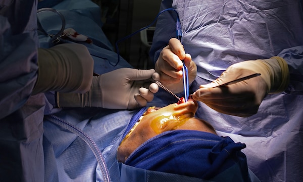 YOKOSUKA, Japan (March 9, 2026) — Capt. Matthew Keller, right, an ear, nose and throat and facial plastic surgeon assigned to U.S. Naval Hospital (USNH) Yokosuka, performs nasal reconstruction using electrocautery and precision instruments while Hospital Corpsman 3rd Class Shaun Tuni, left, a surgical technologist assigned to USNH Yokosuka, assists during a functional septorhinoplasty. USNH Yokosuka provides forward-deployed surgical capabilities that enhance warfighter readiness and improve patient care across the Indo-Pacific region. (U.S. Navy photo by Daniel Taylor/USNMRTC Yokosuka Public Affairs)