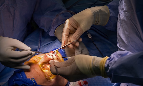 YOKOSUKA, Japan (March 9, 2026) — A close-up view shows suturing and tissue manipulation during nasal reconstruction surgery performed at U.S. Naval Hospital Yokosuka. USNH Yokosuka provides forward-deployed surgical capabilities that enhance warfighter readiness and improve patient care across the Indo-Pacific region. (U.S. Navy photo by Daniel Taylor/USNMRTC Yokosuka Public Affairs)