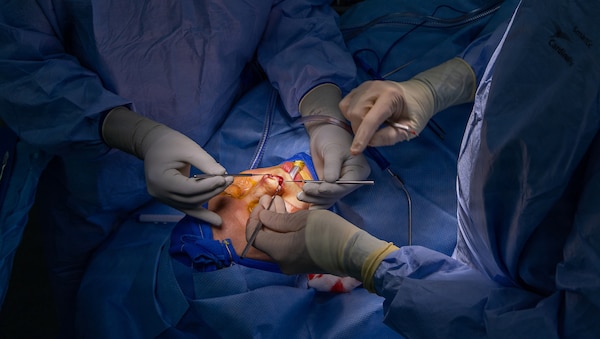 YOKOSUKA, Japan (March 9, 2026) — Capt. Matthew Keller, an ear, nose and throat and facial plastic surgeon assigned to U.S. Naval Hospital (USNH) Yokosuka, and Hospital Corpsman 3rd Class Shaun Tuni, a surgical technologist assigned to USNH Yokosuka, perform structural reconstruction of the nose during a functional septorhinoplasty using precision instruments and electrocautery. USNH Yokosuka provides forward-deployed surgical capabilities that enhance warfighter readiness and improve patient care across the Indo-Pacific region. (U.S. Navy photo by Daniel Taylor/USNMRTC Yokosuka Public Affairs)