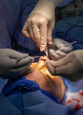 YOKOSUKA, Japan (March 9, 2026) — Capt. Matthew Keller, an ear, nose and throat and facial plastic surgeon assigned to U.S. Naval Hospital (USNH) Yokosuka and Hospital Corpsman 3rd Class Shaun Tuni, a surgical technologist assigned to USNH Yokosuka perform a functional septorhinoplasty and inferior turbinate reduction under surgical lighting in an operating room. USNH Yokosuka provides forward-deployed surgical capabilities that enhance warfighter readiness and improve patient care across the Indo-Pacific region. (U.S. Navy photo by Daniel Taylor/USNMRTC Yokosuka Public Affairs)