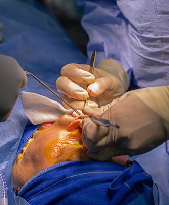 YOKOSUKA, Japan (March 9, 2026) — Capt. Matthew Keller, right, an ear, nose and throat and facial plastic surgeon assigned to U.S. Naval Hospital (USNH) Yokosuka, and Hospital Corpsman 3rd Class Shaun Tuni, left, a surgical technologist assigned to USNH Yokosuka, perform a functional septorhinoplasty and inferior turbinate reduction under surgical lighting in an operating room. USNH Yokosuka provides forward-deployed surgical capabilities that enhance warfighter readiness and improve patient care across the Indo-Pacific region. (U.S. Navy photo by Daniel Taylor/USNMRTC Yokosuka Public Affairs)