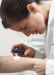 Healthcare providers encourage people to regularly check their skin for changes in moles, new growths and a sore that doesn’t seem to want to heal, as well as have physicians check the skin for irregularities during regular checkups.